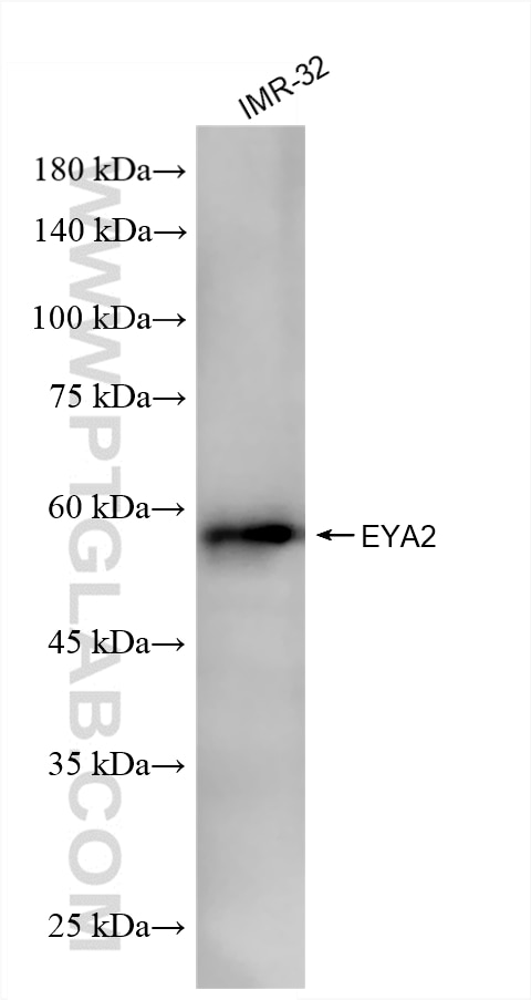 WB analysis of IMR-32 using 86046-2-RR (same clone as 86046-2-PBS) Western Blot (WB) analysis of IMR-32 cells using EYA2 Recombinant monoclonal antibody (86046-2-RR)