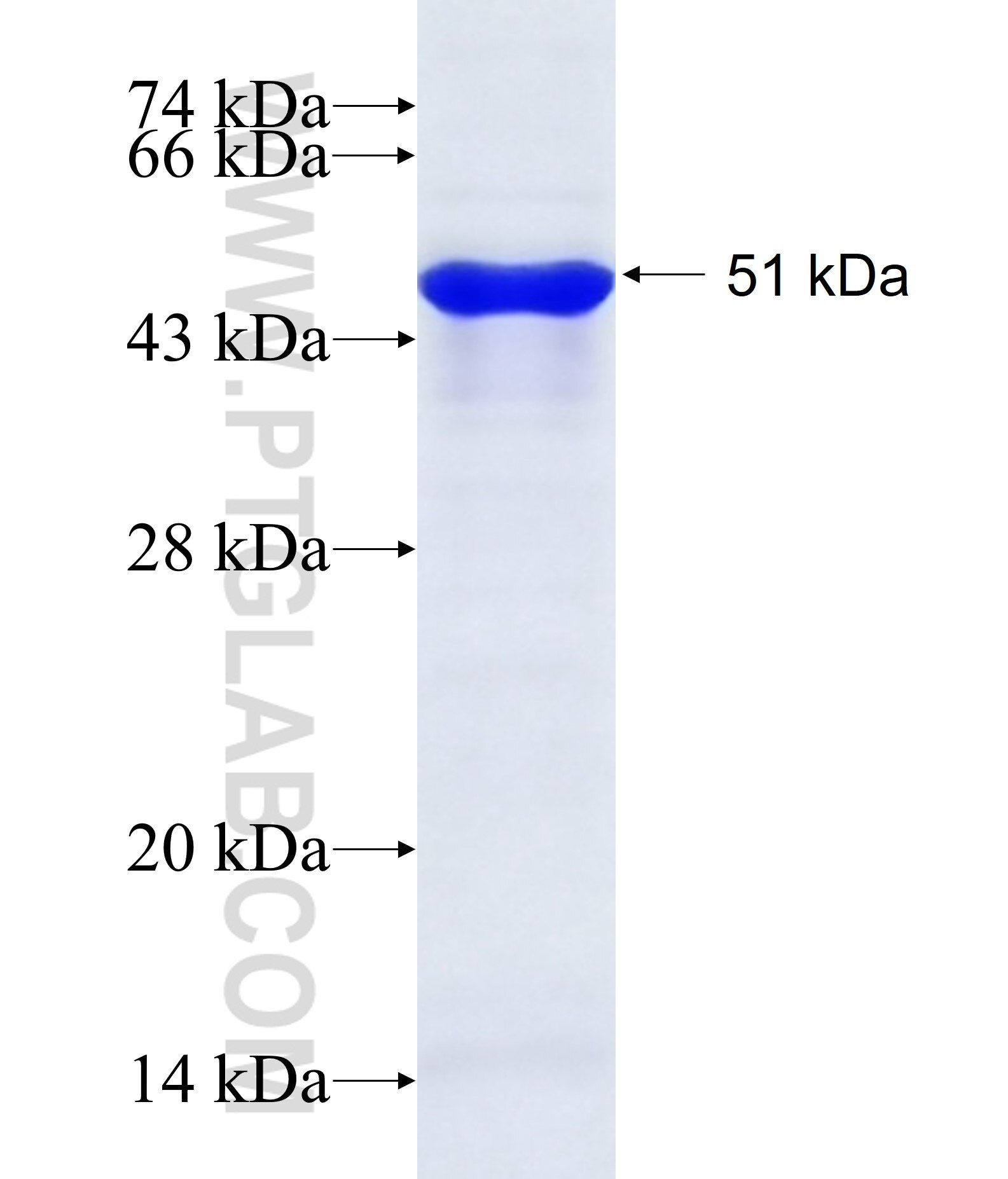 EYA2 fusion protein Ag29403 SDS-PAGE