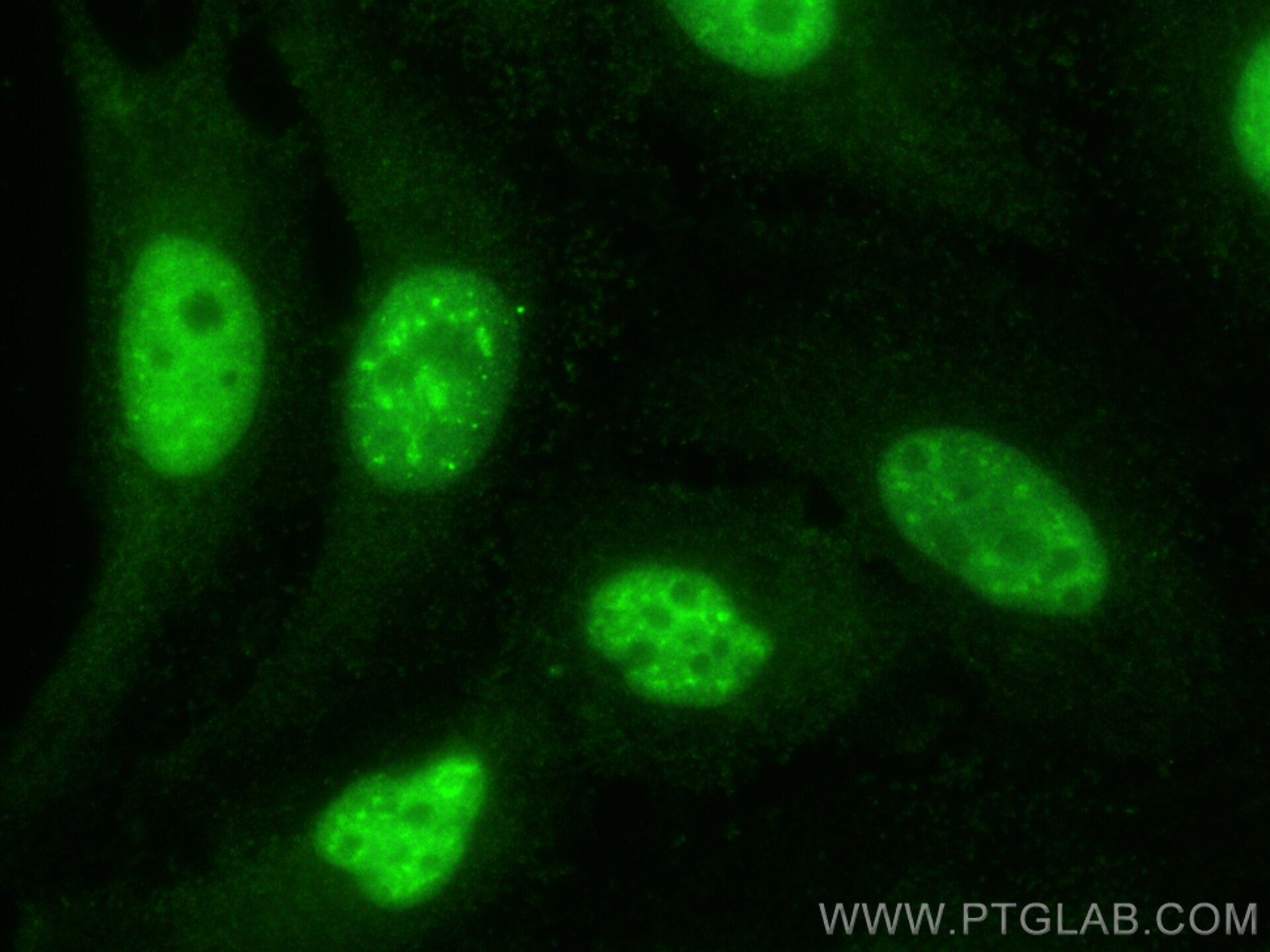 Immunofluorescence (IF) / fluorescent staining of HeLa cells using EYA3 Polyclonal antibody (21196-1-AP)