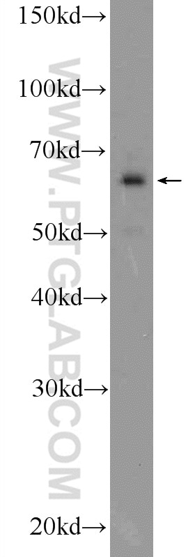 WB analysis of HeLa using 21196-1-AP