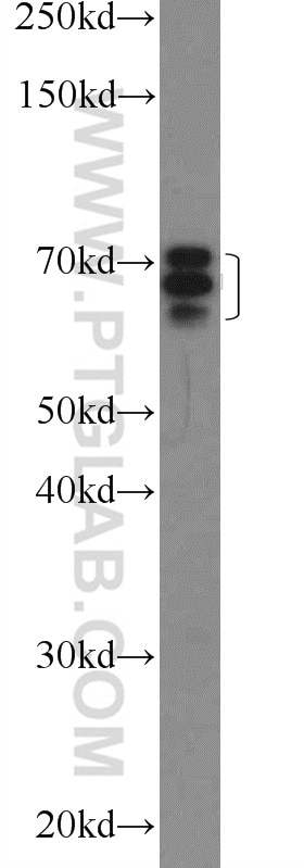 Western Blot (WB) analysis of L02 cells using EYA3 Polyclonal antibody (21196-1-AP)