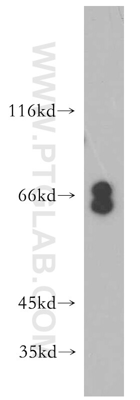 Western Blot (WB) analysis of HeLa cells using EYA3 Polyclonal antibody (21196-1-AP)