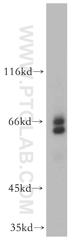 Western Blot (WB) analysis of L02 cells using EYA3 Polyclonal antibody (21196-1-AP)