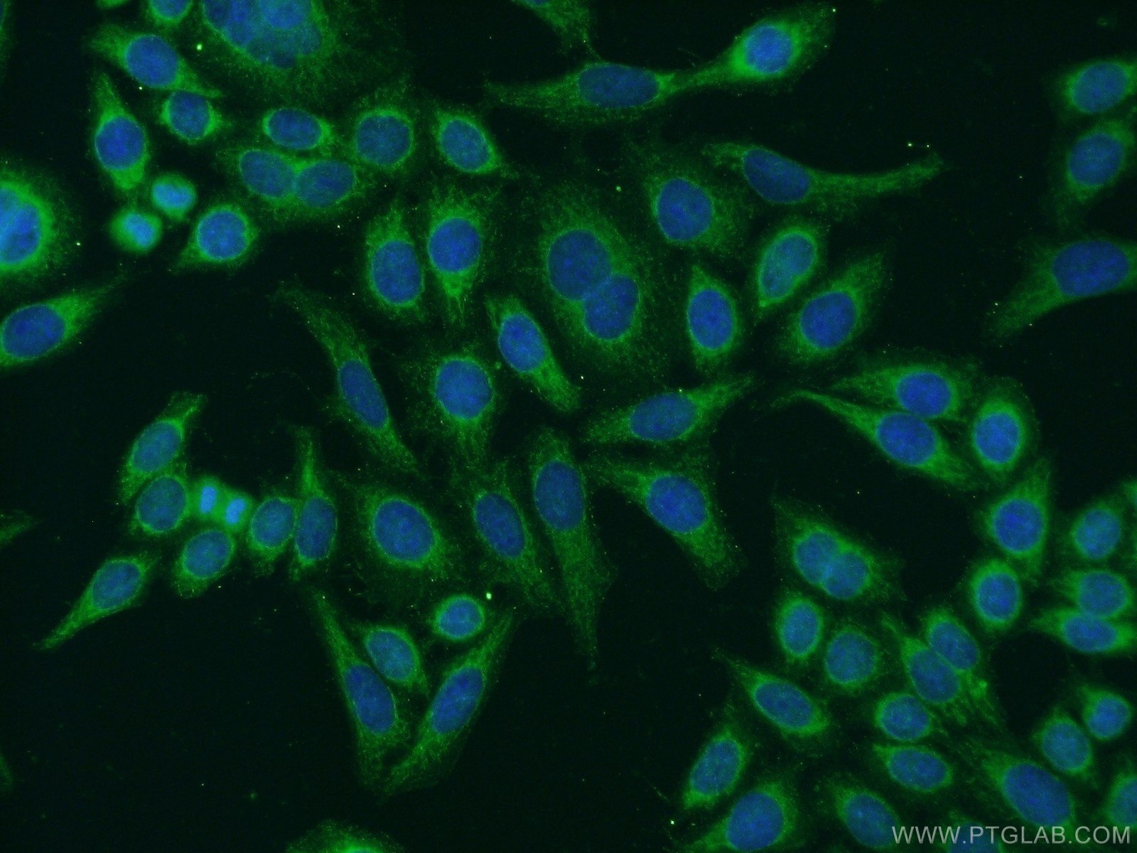 Immunofluorescence (IF) / fluorescent staining of HeLa cells using EYA4 Polyclonal antibody (24691-1-AP)