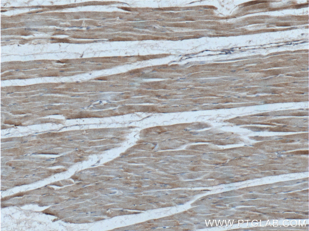 Immunohistochemistry (IHC) staining of human skeletal muscle tissue using EYA4 Polyclonal antibody (24691-1-AP)