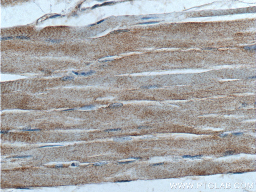 Immunohistochemistry (IHC) staining of human skeletal muscle tissue using EYA4 Polyclonal antibody (24691-1-AP)
