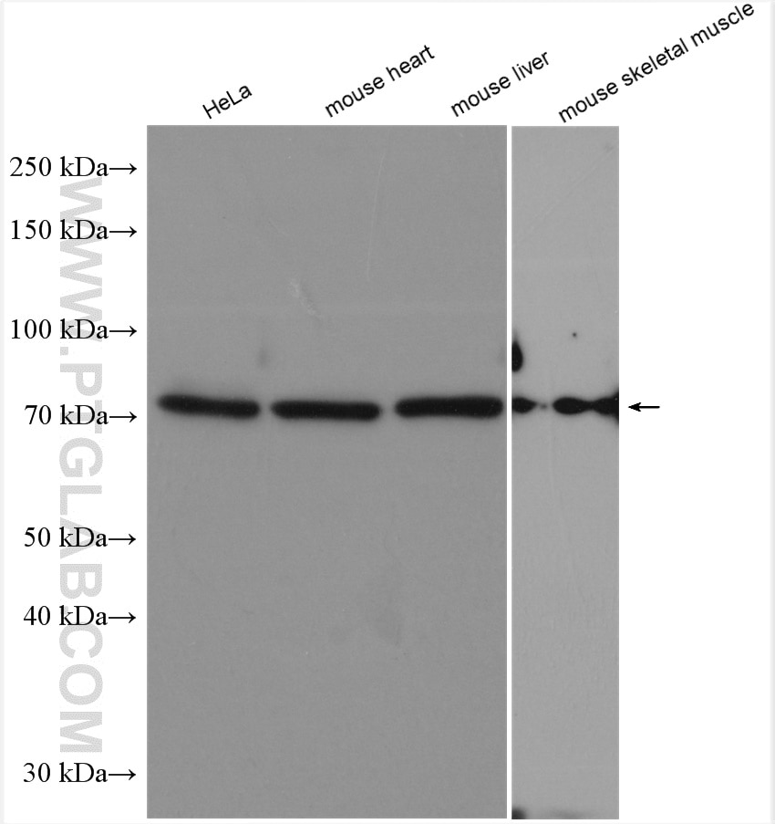 Western Blot (WB) analysis of various lysates using EYA4 Polyclonal antibody (24691-1-AP)