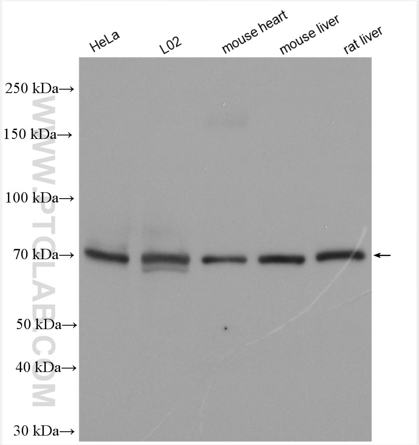 Western Blot (WB) analysis of various lysates using EYA4 Polyclonal antibody (24691-1-AP)