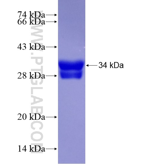 EYA4 fusion protein Ag20466 SDS-PAGE
