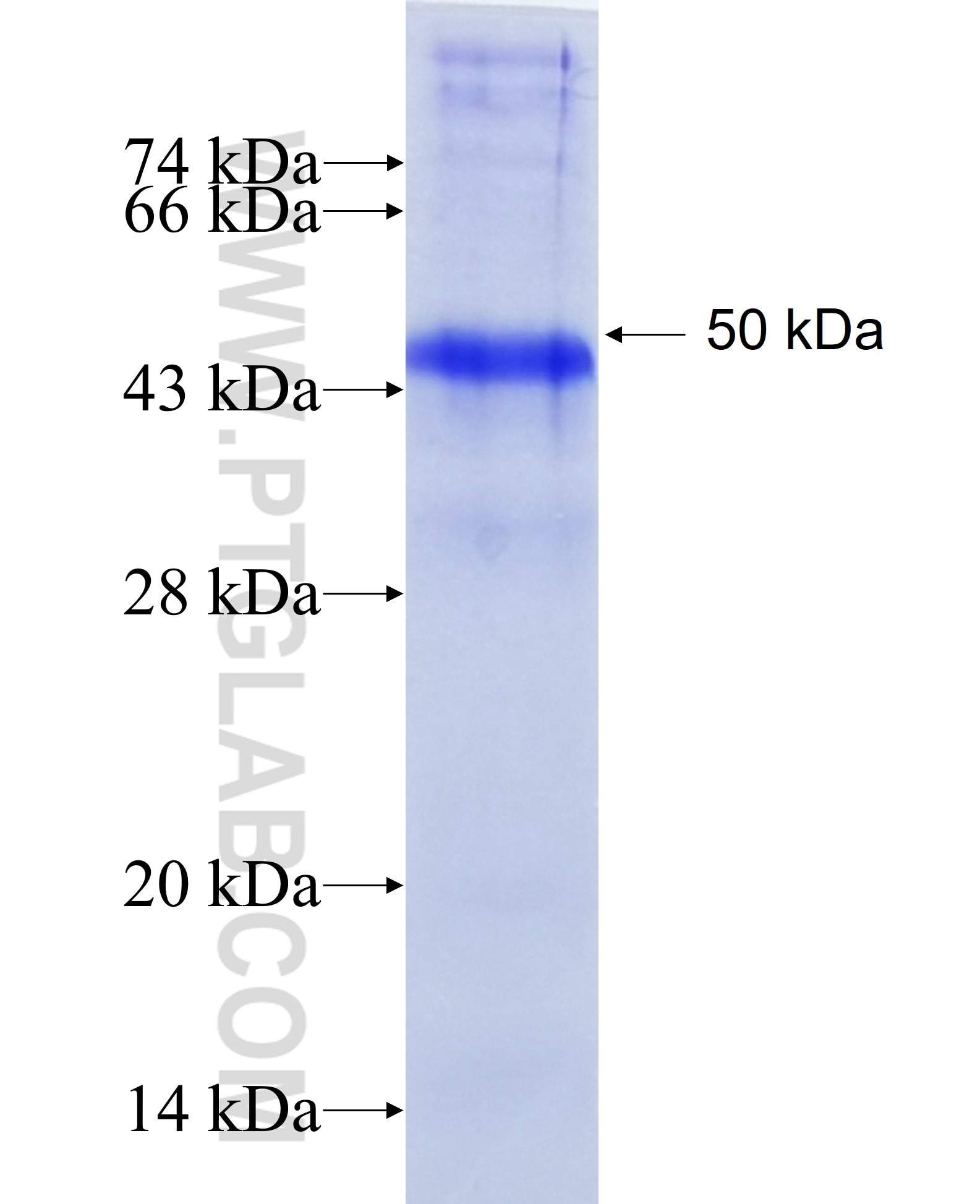 EYS fusion protein Ag22389 SDS-PAGE