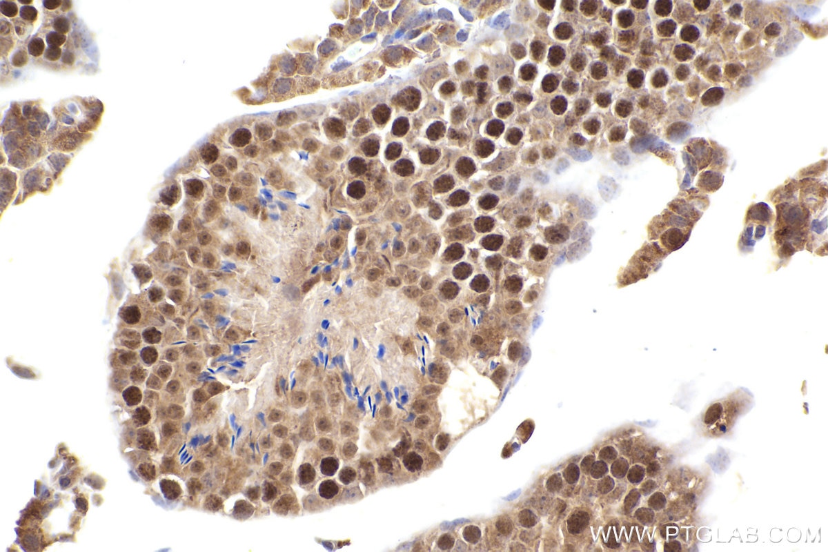 Immunohistochemistry (IHC) staining of mouse testis tissue using EZH2 Polyclonal antibody (21800-1-AP)