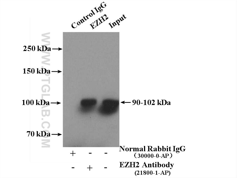 Immunoprecipitation (IP) experiment of HepG2 cells using EZH2 Polyclonal antibody (21800-1-AP)