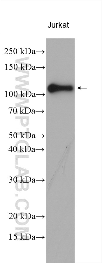 Western Blot (WB) analysis of various lysates using EZH2 Polyclonal antibody (21800-1-AP)