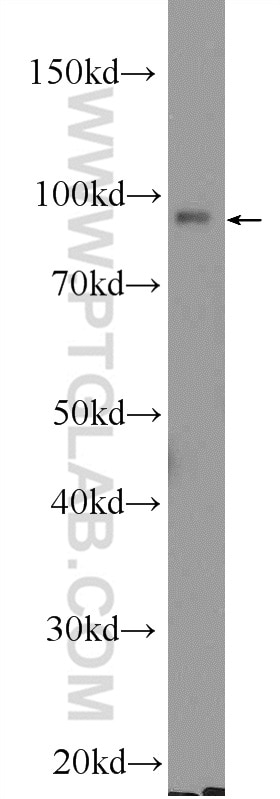 Western Blot (WB) analysis of rat kidney tissue using EZH2 Polyclonal antibody (21800-1-AP)