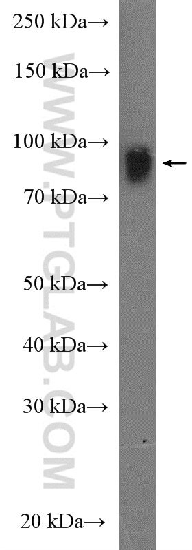 Western Blot (WB) analysis of Raji cells using EZH2 Polyclonal antibody (21800-1-AP)