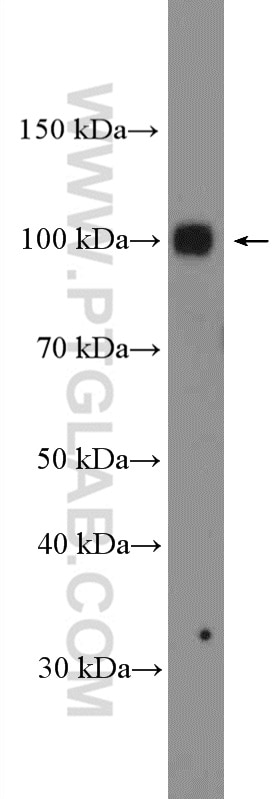 Western Blot (WB) analysis of DU 145 cells using EZH2 Polyclonal antibody (21800-1-AP)