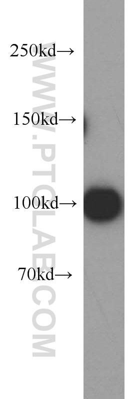 WB analysis of HEK-293 using 21800-1-AP