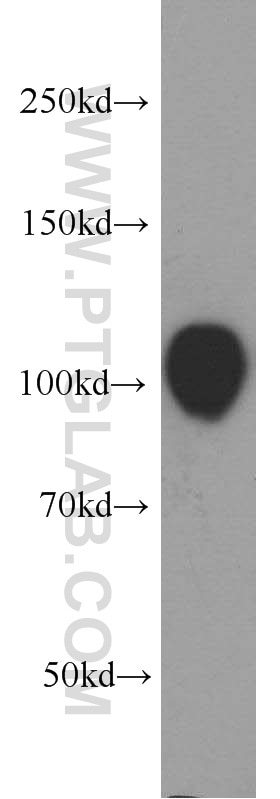 EZH2 Polyclonal antibody