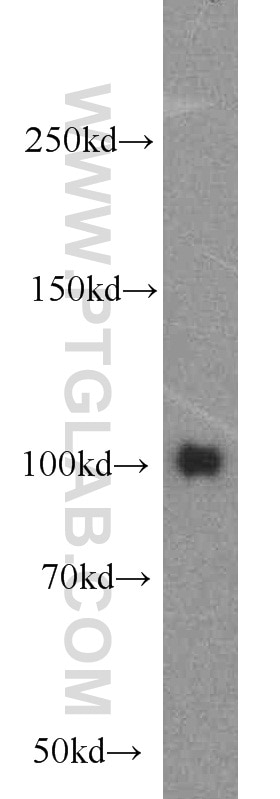 WB analysis of mouse kidney using 21800-1-AP