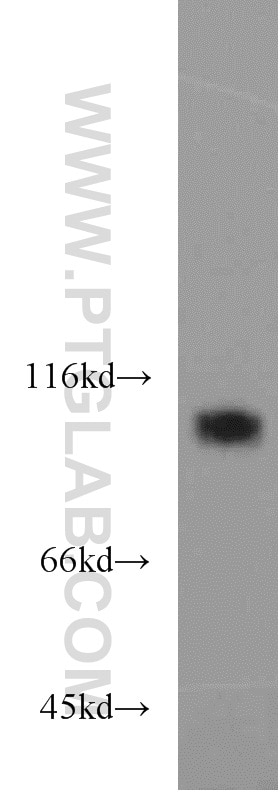 Western Blot (WB) analysis of A431 cells using EZH2 Polyclonal antibody (21800-1-AP)