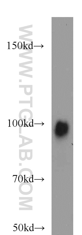 Western Blot (WB) analysis of HepG2 cells using EZH2 Polyclonal antibody (21800-1-AP)