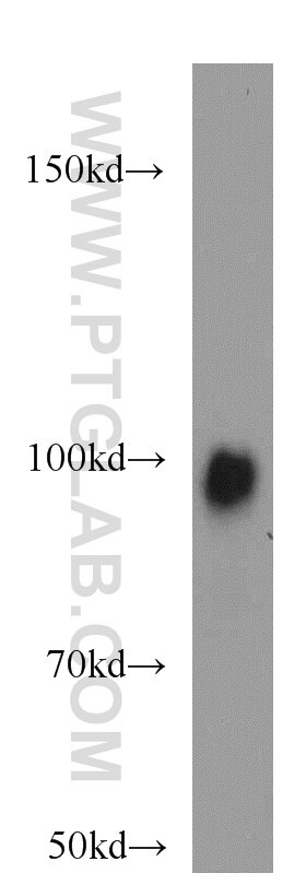 WB analysis of HepG2 using 21800-1-AP