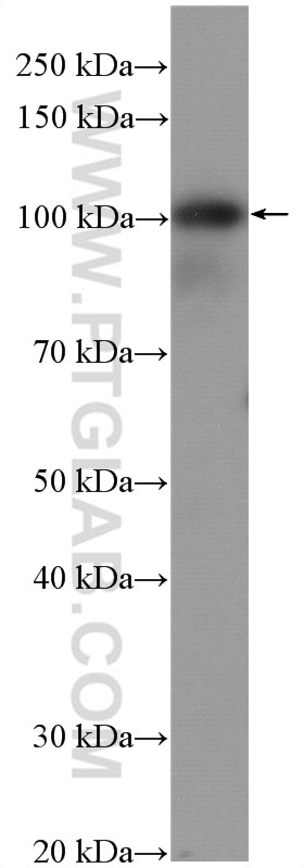 Western Blot (WB) analysis of Jurkat cells using EZH2 Monoclonal antibody (66476-1-Ig)