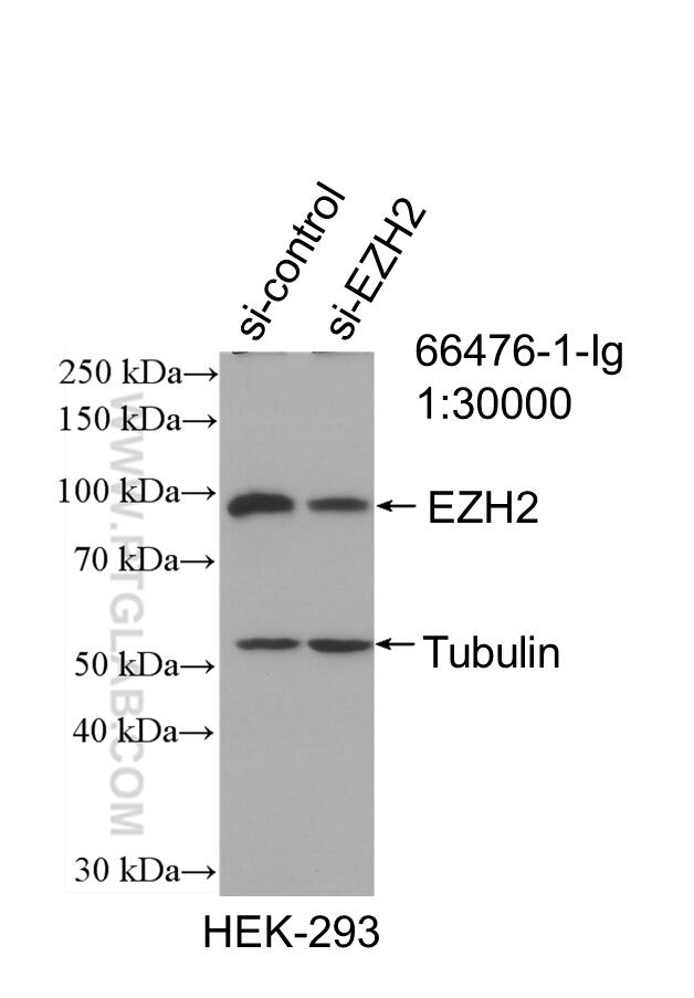 Western Blot (WB) analysis of HEK-293 cells using EZH2 Monoclonal antibody (66476-1-Ig)