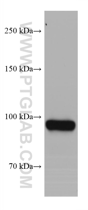 Western Blot (WB) analysis of Jurkat cells using EZH2 Monoclonal antibody (66476-1-Ig)