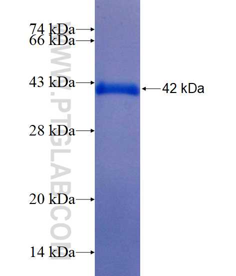 EZH2 fusion protein Ag16789 SDS-PAGE