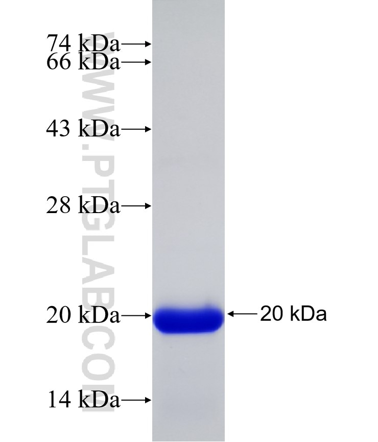 EZH2 fusion protein Ag17437 SDS-PAGE
