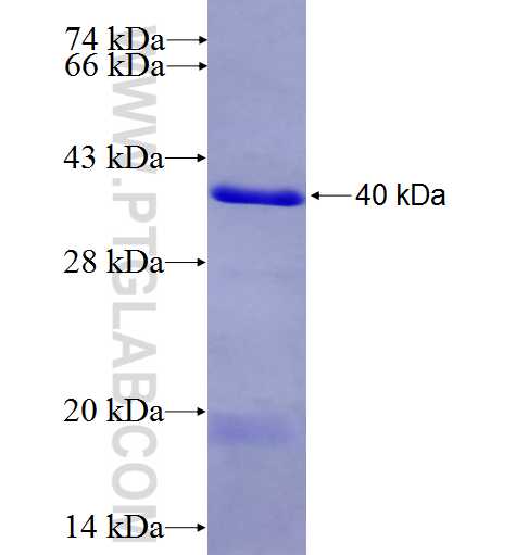 EZH2 fusion protein Ag9141 SDS-PAGE