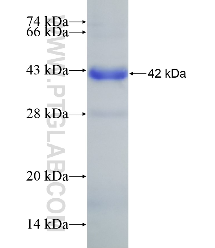 EZH2 fusion protein Ag9142 SDS-PAGE