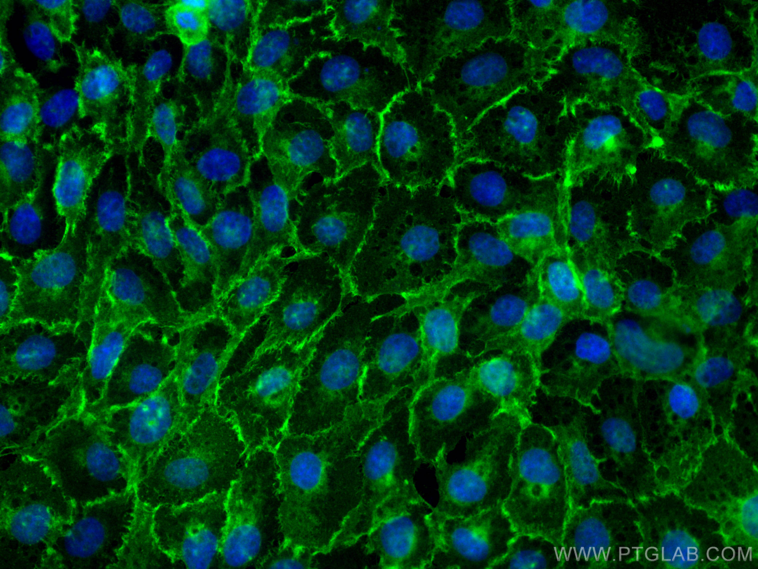 Immunofluorescence (IF) / fluorescent staining of A431 cells using EGFR Polyclonal antibody (30847-1-AP)