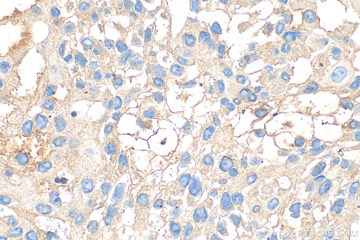 Immunohistochemistry (IHC) staining of mouse placenta tissue using EGFR Polyclonal antibody (30847-1-AP)
