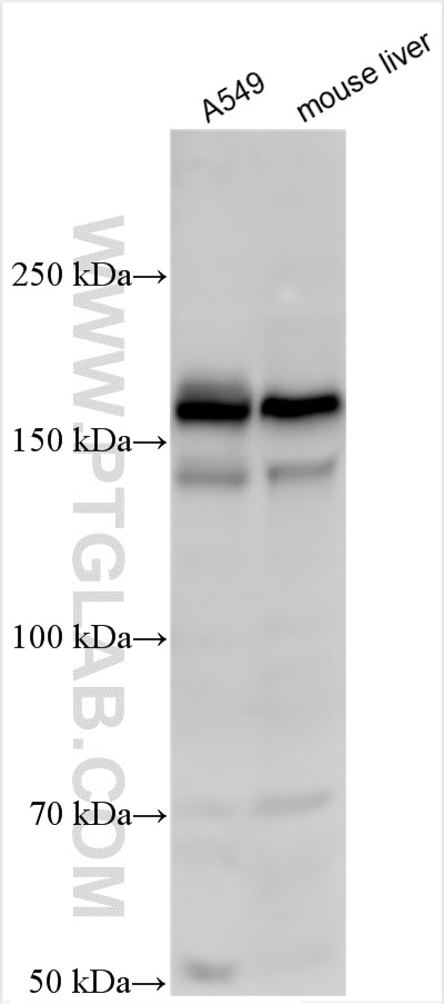 Western Blot (WB) analysis of various lysates using Egfr Polyclonal antibody (30847-1-AP)
