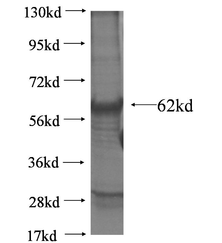Elmod1 fusion protein Ag6325 SDS-PAGE Elmod1 fusion protein Ag6325 SDS-PAGE