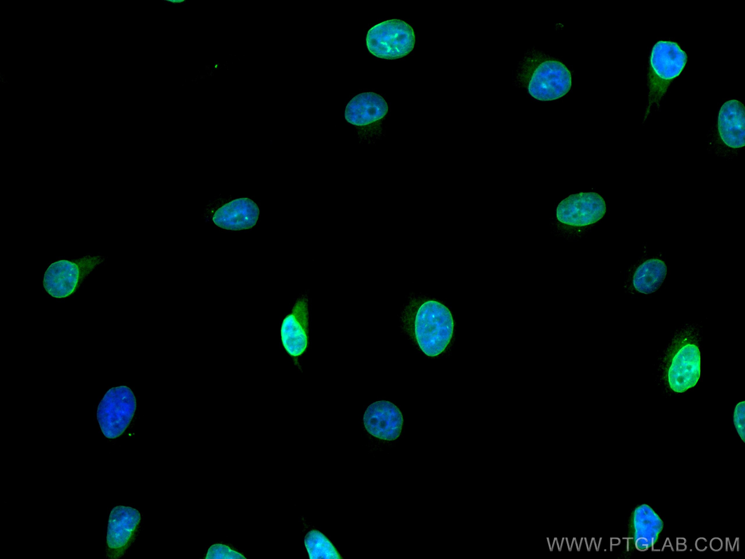 Immunofluorescence (IF) / fluorescent staining of HeLa cells using CoraLite® Plus 488-conjugated Emerin Polyclonal an (CL488-10351)
