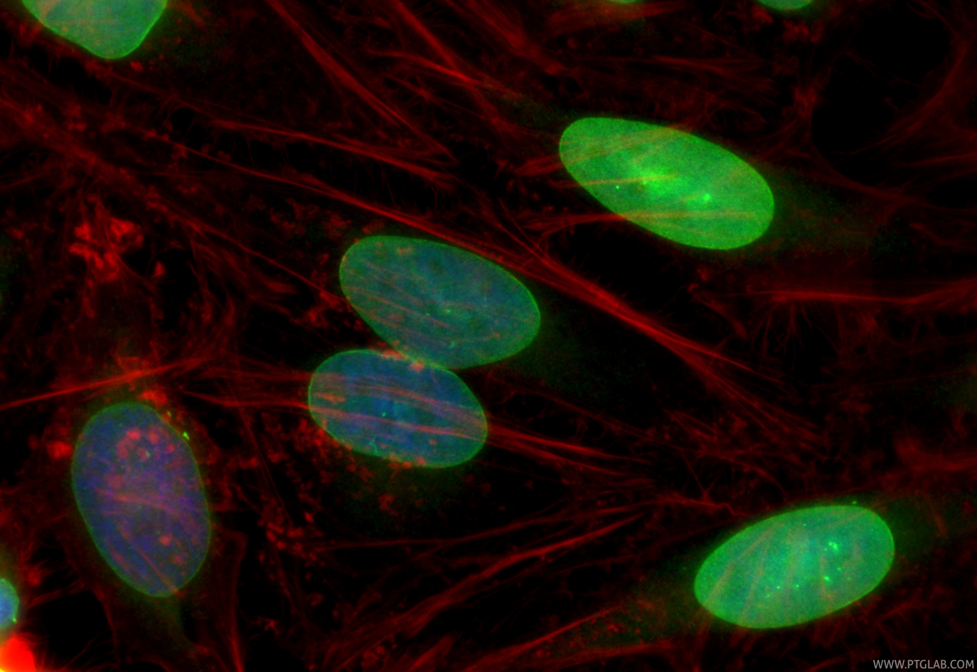Immunofluorescent analysis of (4% PFA) fixed HeLa cells using CoraLite® Plus 488 Emerin antibody (CL488-82888, Clone: 230089B1 ) at dilution of 1:200, CL594-phalloidin (red). Immunofluorescence (IF) / fluorescent staining of HeLa cells using CoraLite® Plus 488-conjugated Emerin Recombinant m (CL488-82888)