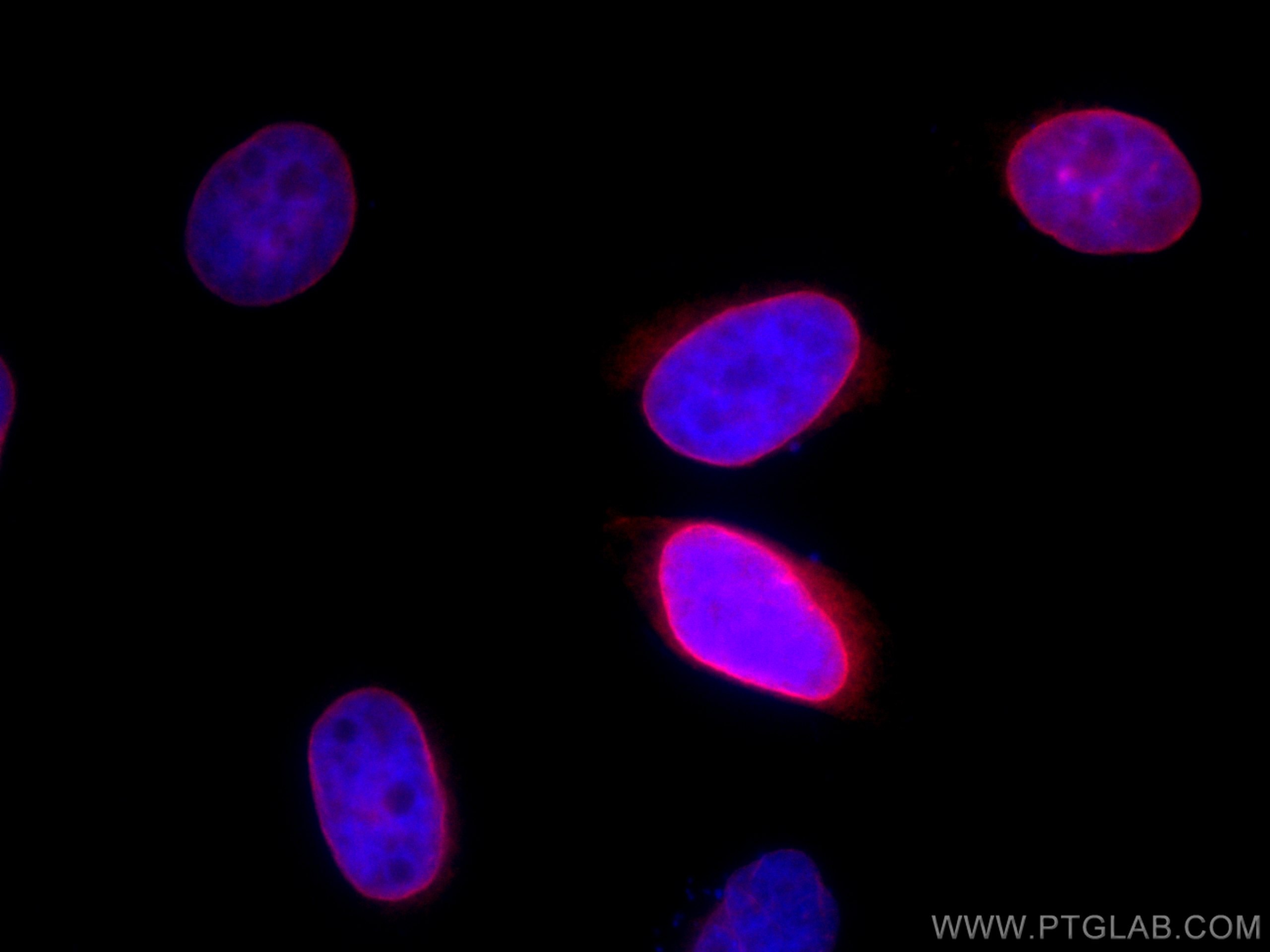 Immunofluorescence (IF) / fluorescent staining of HeLa cells using CoraLite®594-conjugated Emerin Polyclonal antibody (CL594-10351)