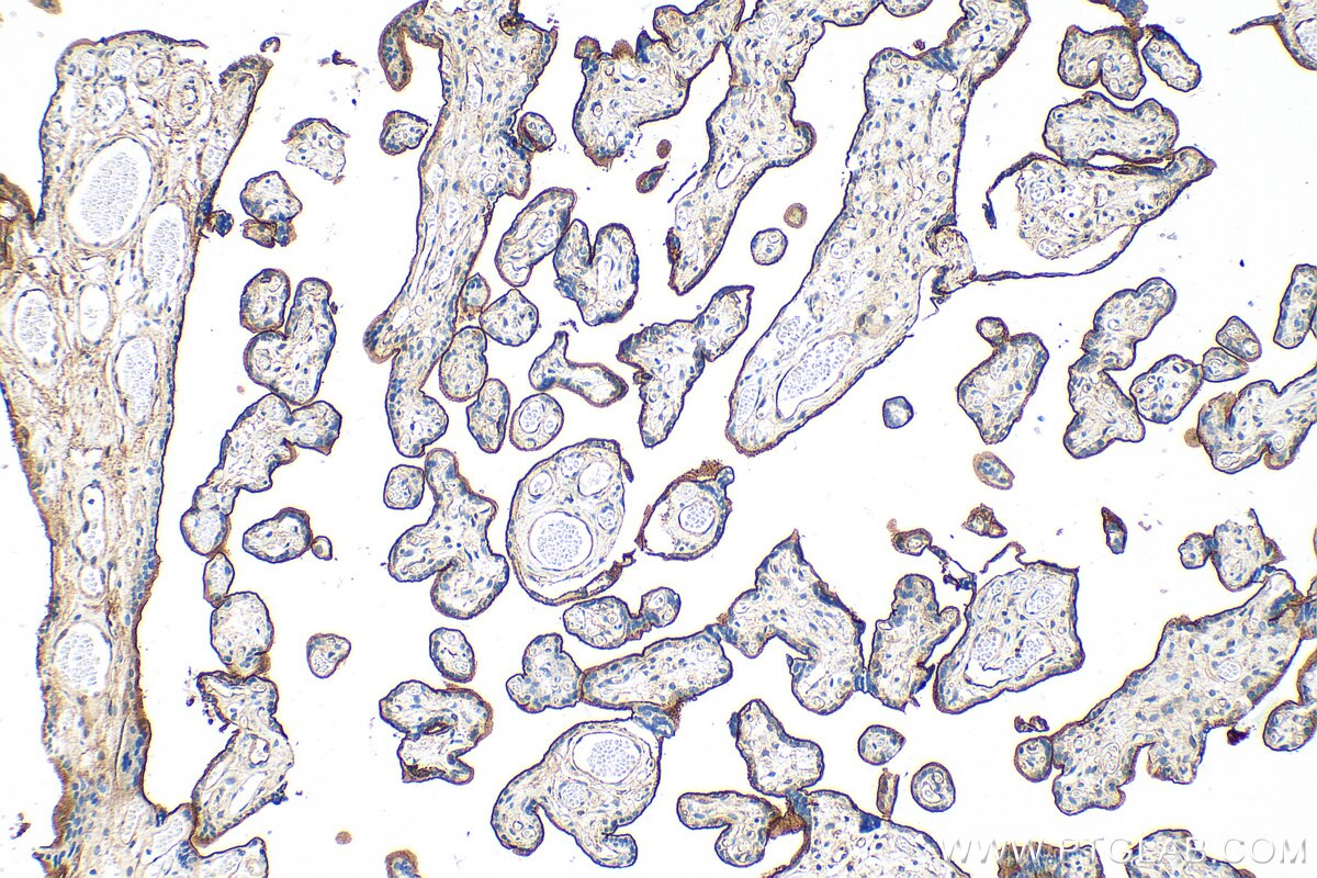 Immunohistochemistry (IHC) staining of human placenta tissue using Endoglin/CD105 Polyclonal antibody (30730-1-AP)