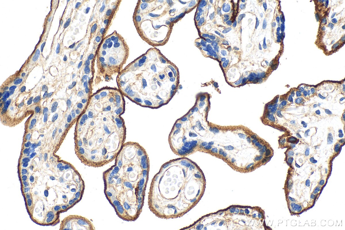 Endoglin/CD105