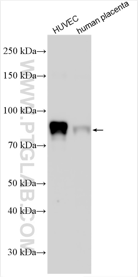Western Blot (WB) analysis of various lysates using Endoglin/CD105 Polyclonal antibody (30730-1-AP)