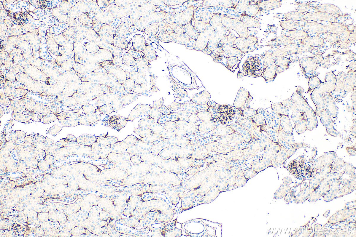 Immunohistochemistry (IHC) staining of mouse kidney tissue using Endoglin/CD105 Polyclonal antibody (32665-1-AP)