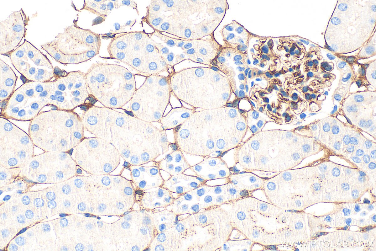 Immunohistochemistry (IHC) staining of mouse kidney tissue using Endoglin/CD105 Polyclonal antibody (32665-1-AP)