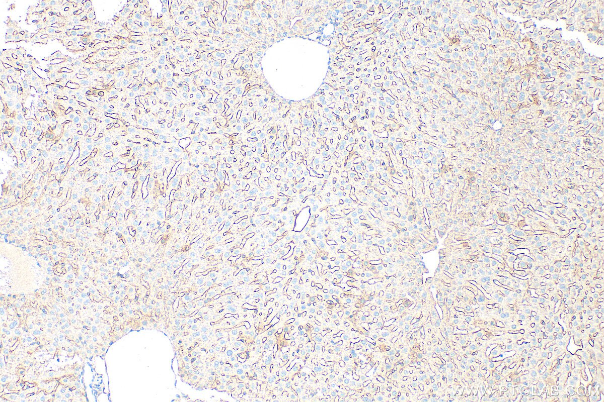 Immunohistochemistry (IHC) staining of mouse liver tissue using Endoglin/CD105 Polyclonal antibody (32665-1-AP)