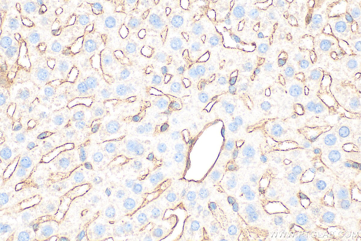 Immunohistochemistry (IHC) staining of mouse liver tissue using Endoglin/CD105 Polyclonal antibody (32665-1-AP)