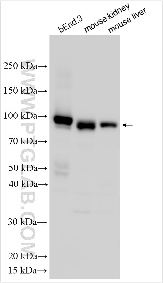 Western Blot (WB) analysis of various lysates using Endoglin/CD105 Polyclonal antibody (32665-1-AP)