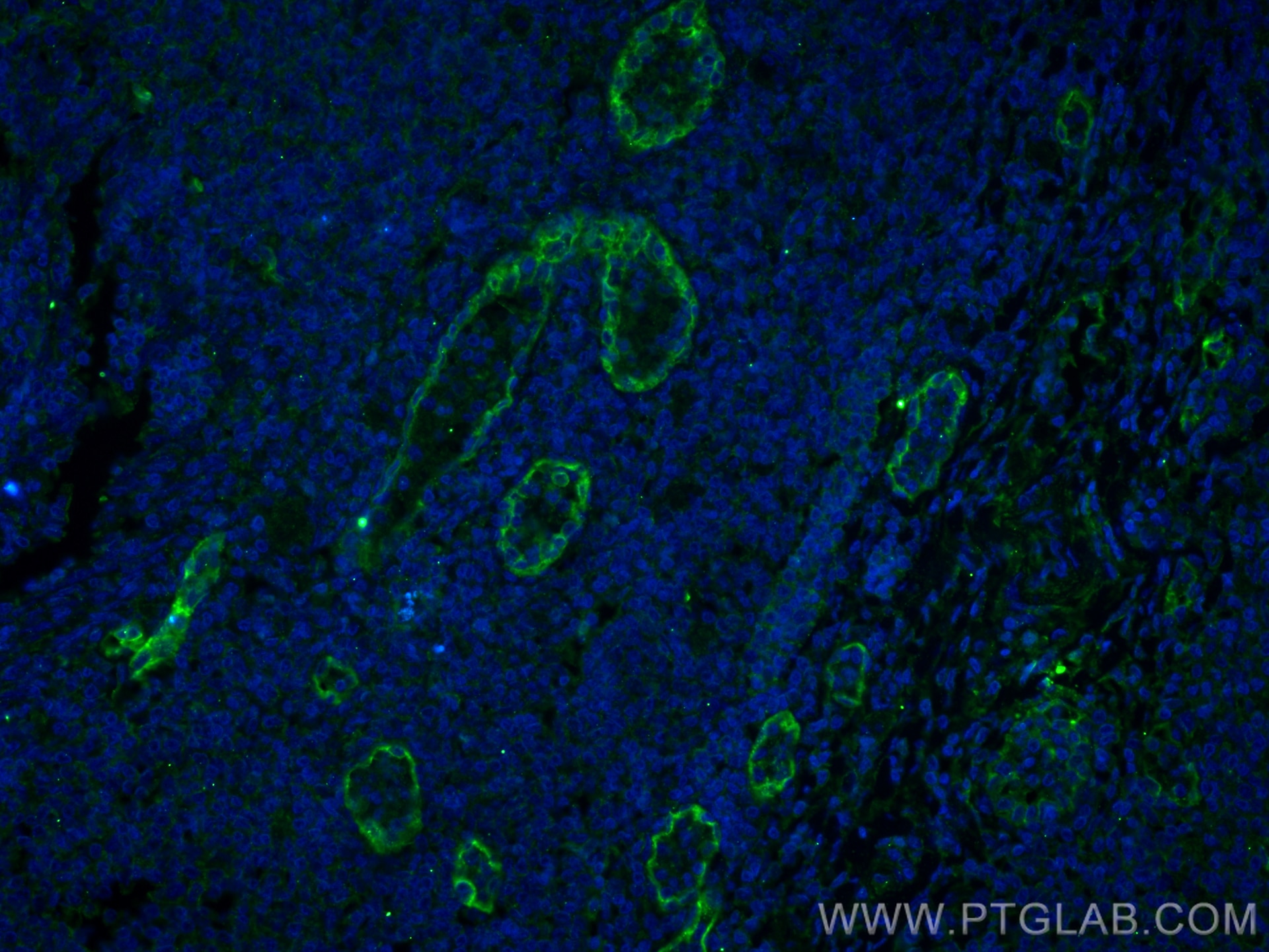 Immunofluorescence (IF) / fluorescent staining of human tonsillitis tissue using Endoglin/CD105 Monoclonal antibody (67075-1-Ig)