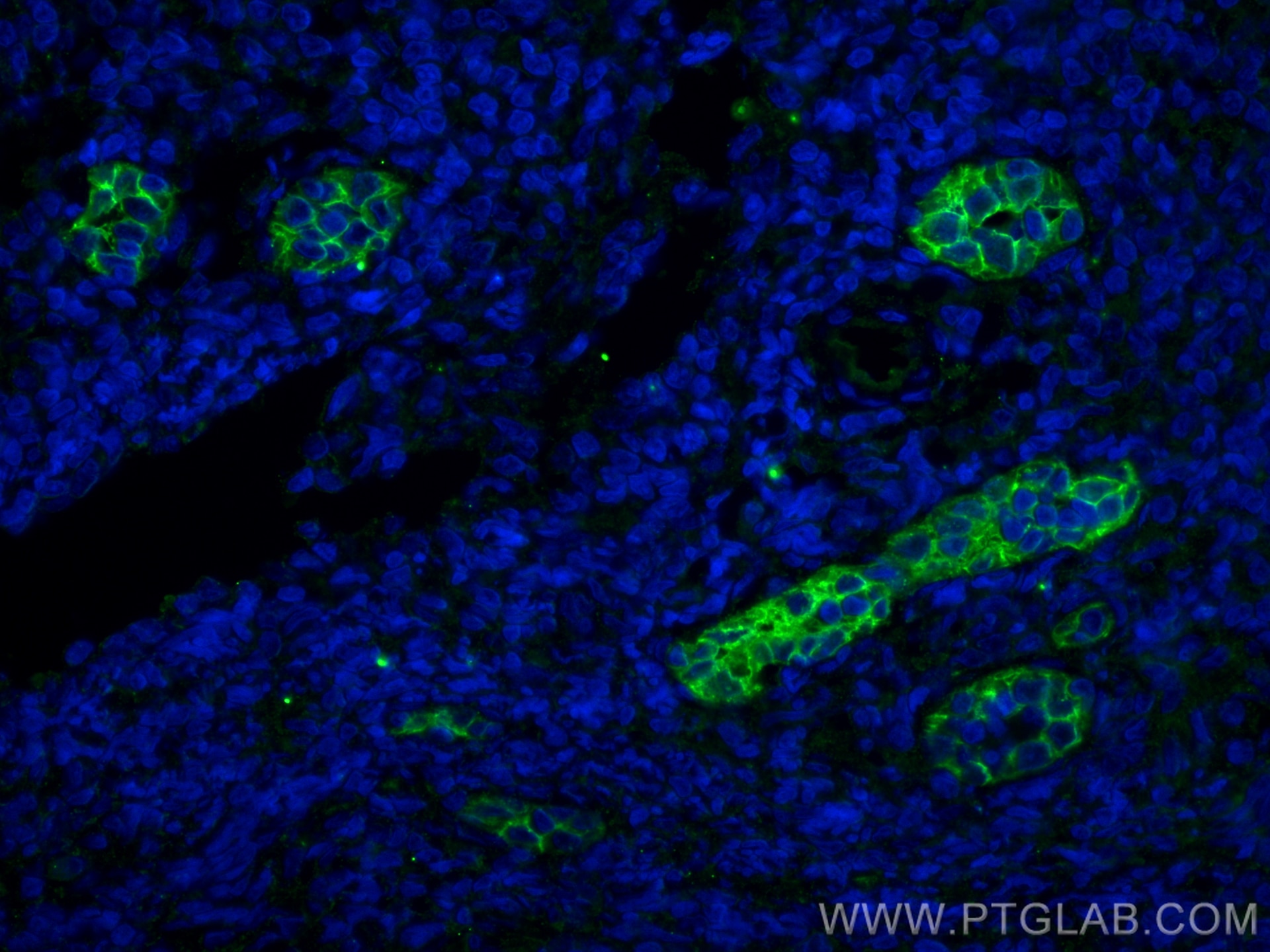 Immunofluorescence (IF) / fluorescent staining of human tonsillitis tissue using Endoglin/CD105 Monoclonal antibody (67075-1-Ig)